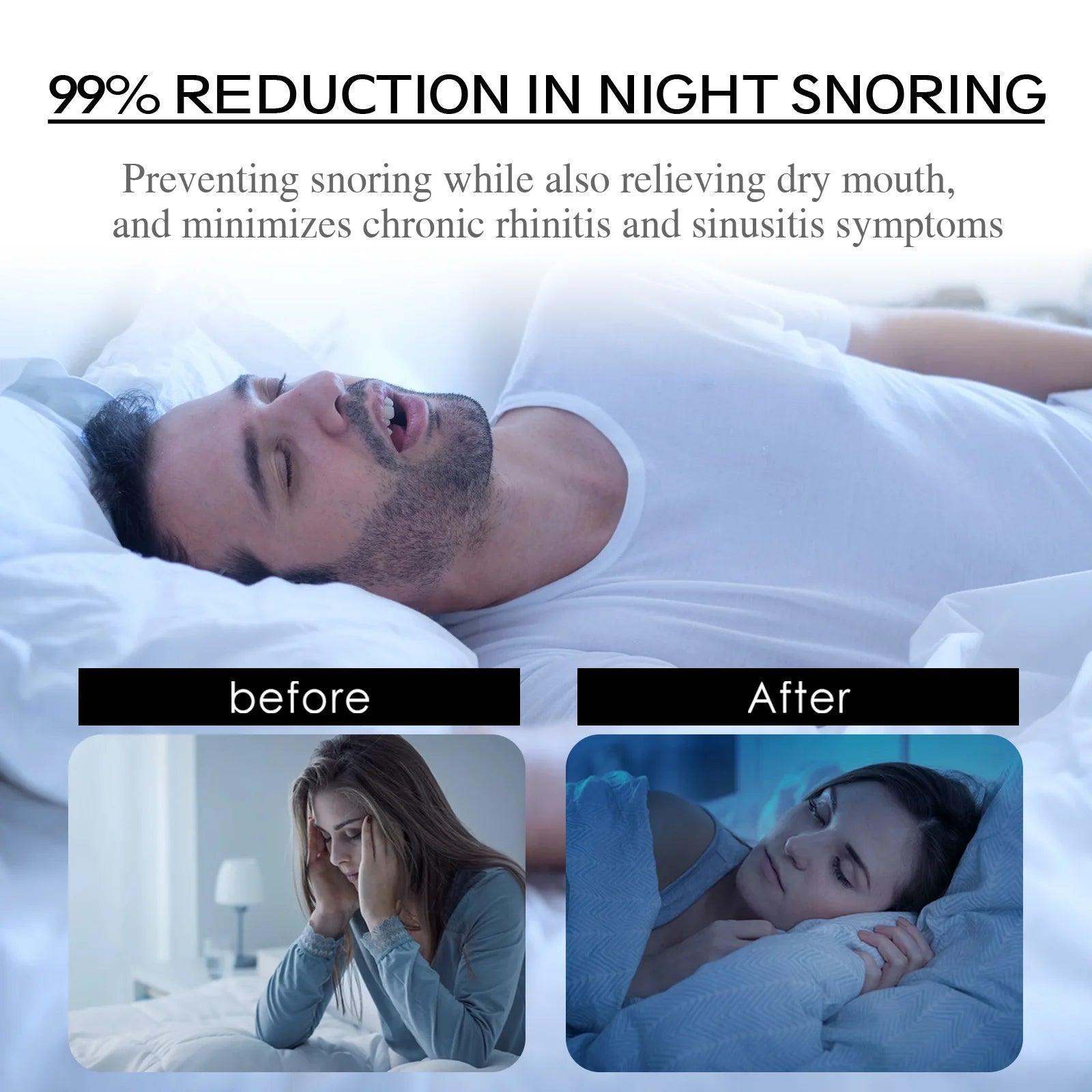 SnoozeEase Anti - Snoring Patch - Breathing - SolisSleep